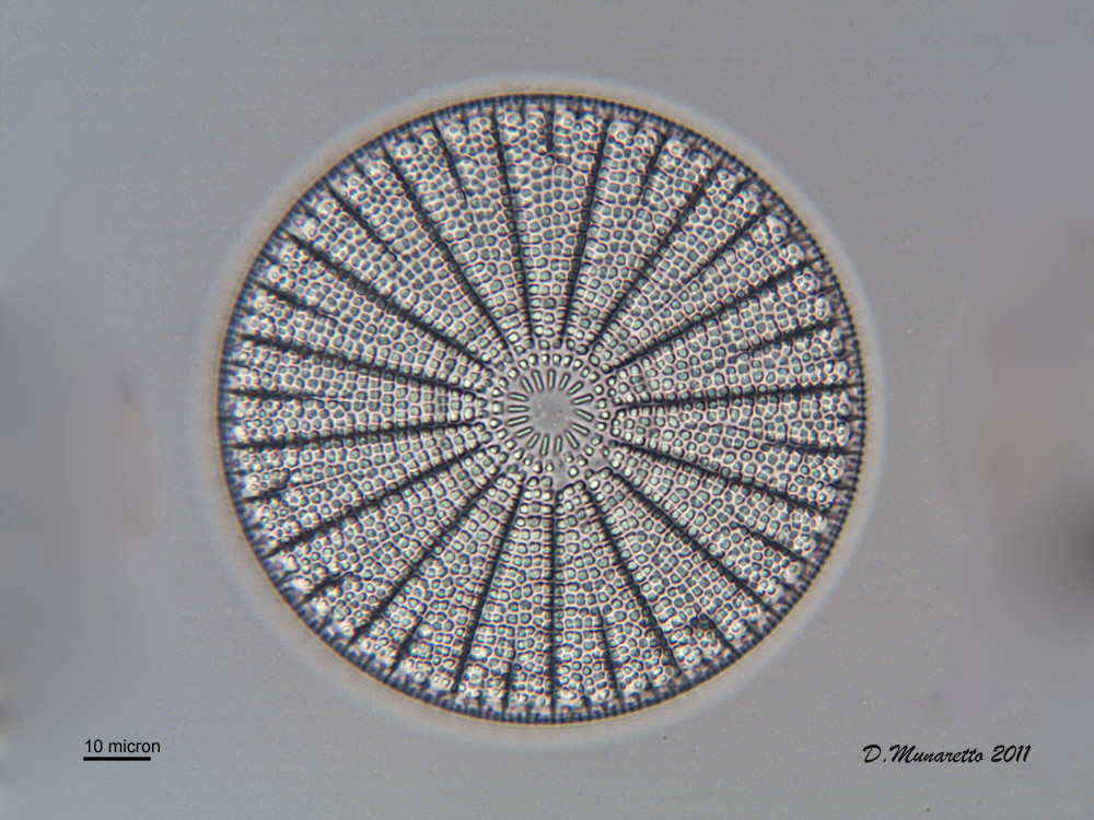 Diatomea Color vs B/N ...due